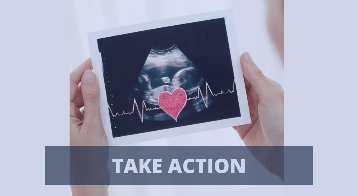 Sonogram photo with the words "Take Action"